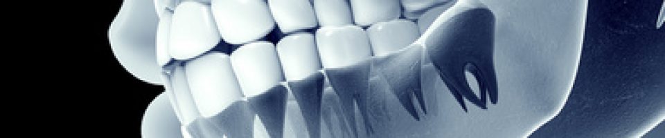 x-ray teeth