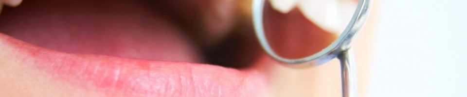 Teeth examination in Beverly Hills